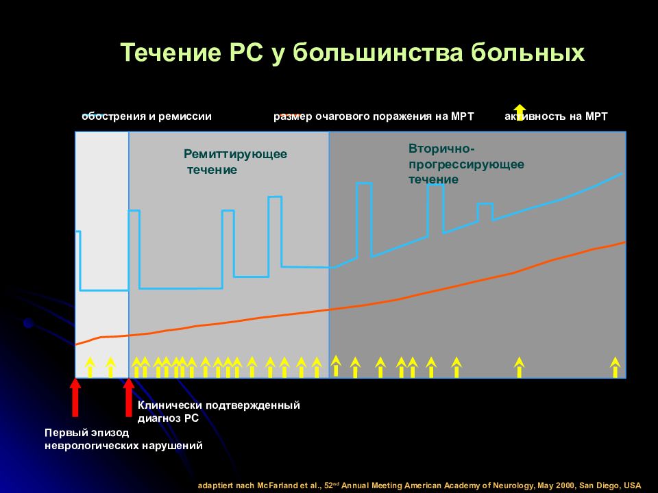 Рассеянный склероз прогрессирующее течение. Типы течения рассеянного склероза. Рассеянный склероз статистика. Статистика рассеянного склероза в мире. Ремиттирующий рассеянный склероз.