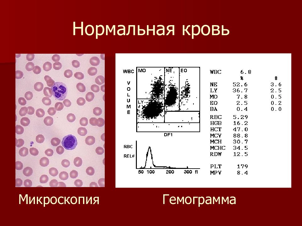 Гемограмма. Скатерограмма лейкоцитов. Скатерограмма крови. Формула крови гемограмма.