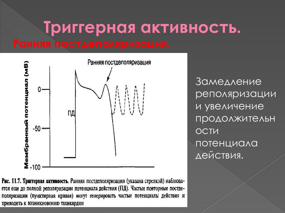 Ранняя активность. Триггернаяактивность ранняяпостдеполяризация. Триггерная активность. Ранняя постдеполяризация. Оаняя посидеполяризация.