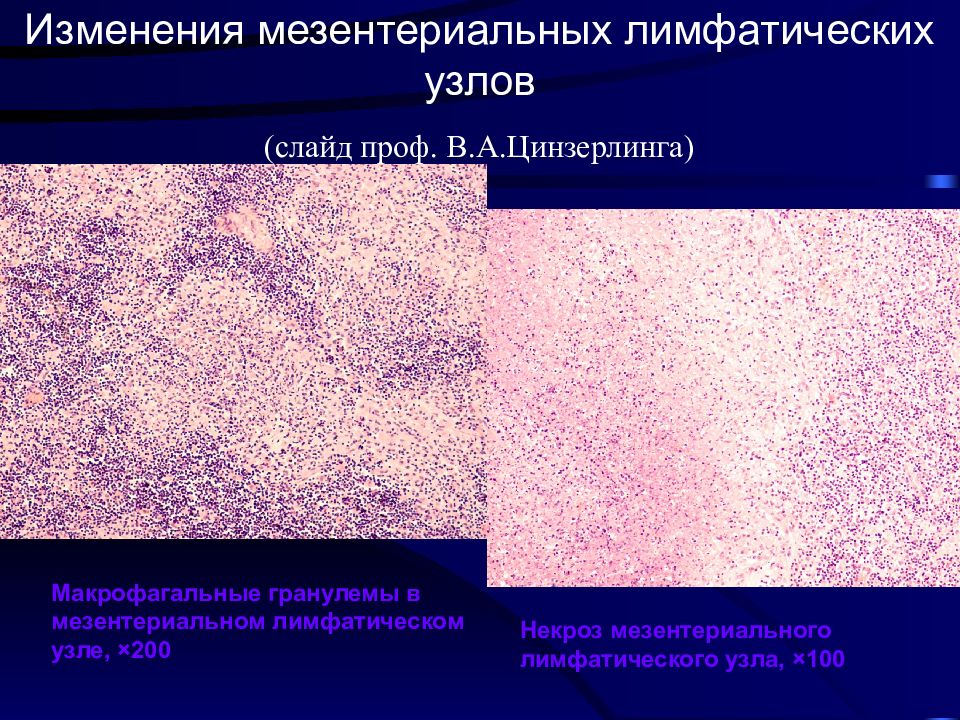 Вич патологическая анатомия презентация