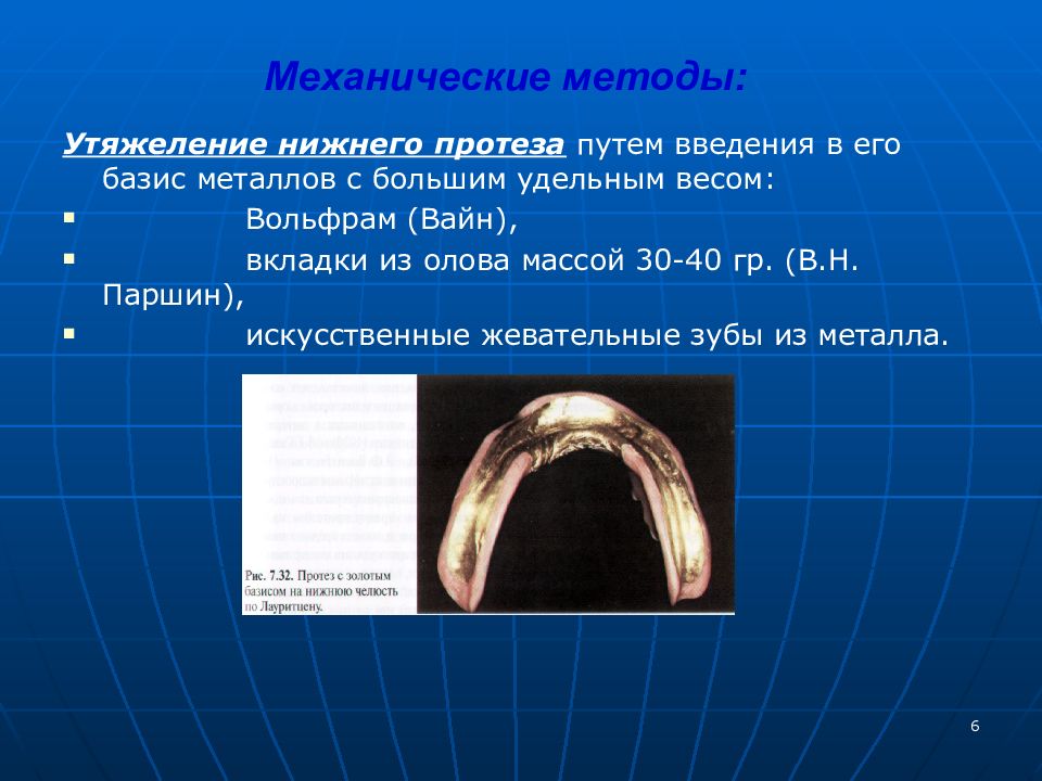 Вкладки ортопедическая стоматология презентация