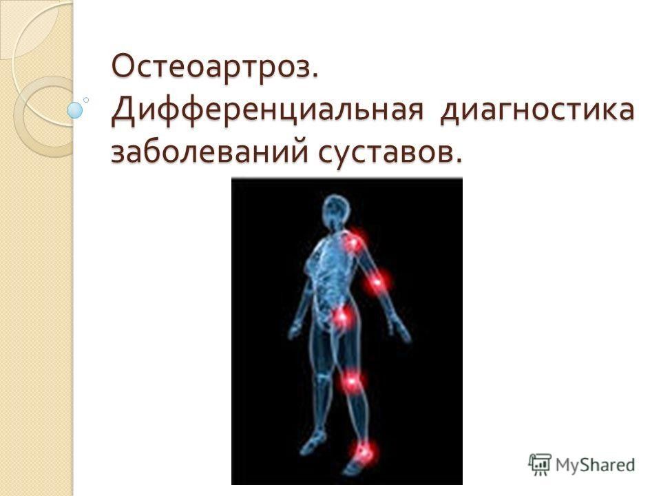 Остеоартроз синдромы. Остеоартроз оформление диагноза. 3 Группы заболевания суставов.