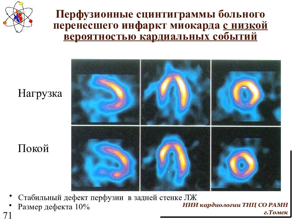 Сцинтиграмма является изображением