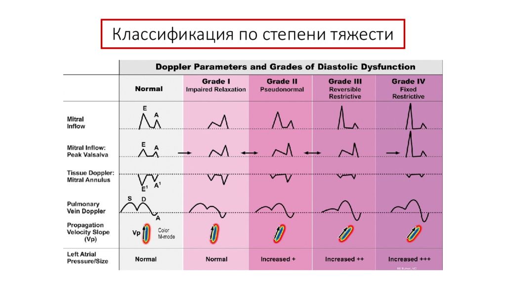 Диастолическое давление левого желудочка