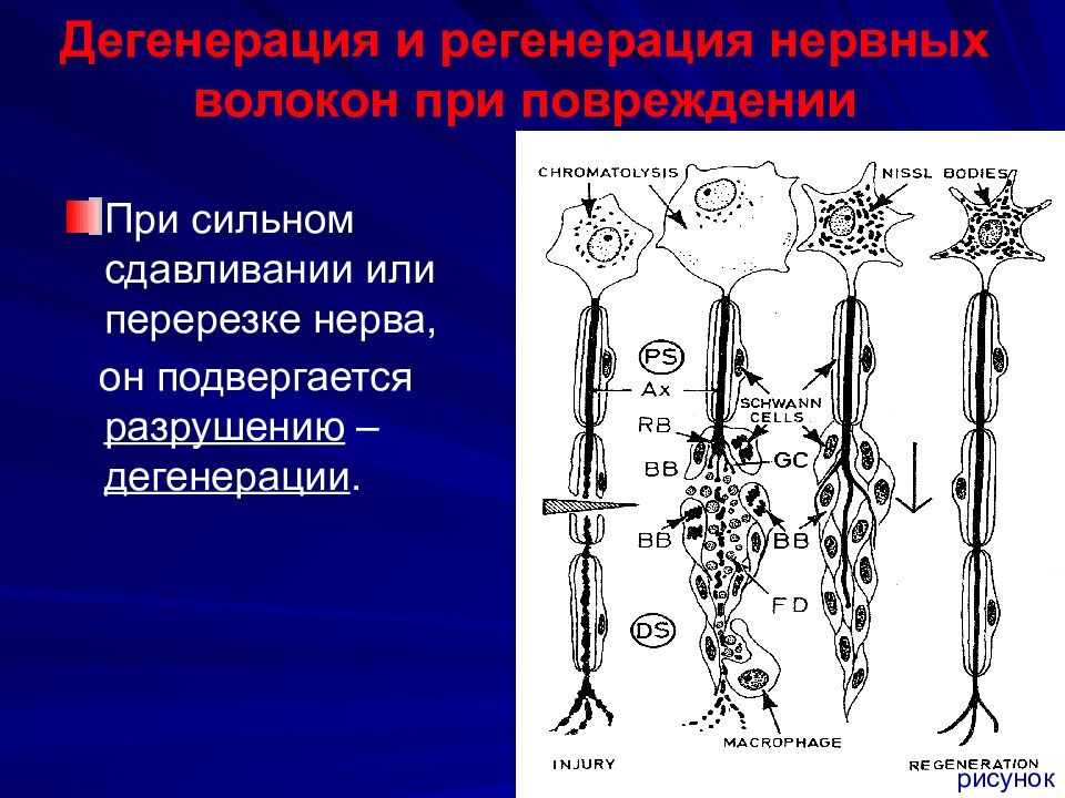 Дегенерации нерва