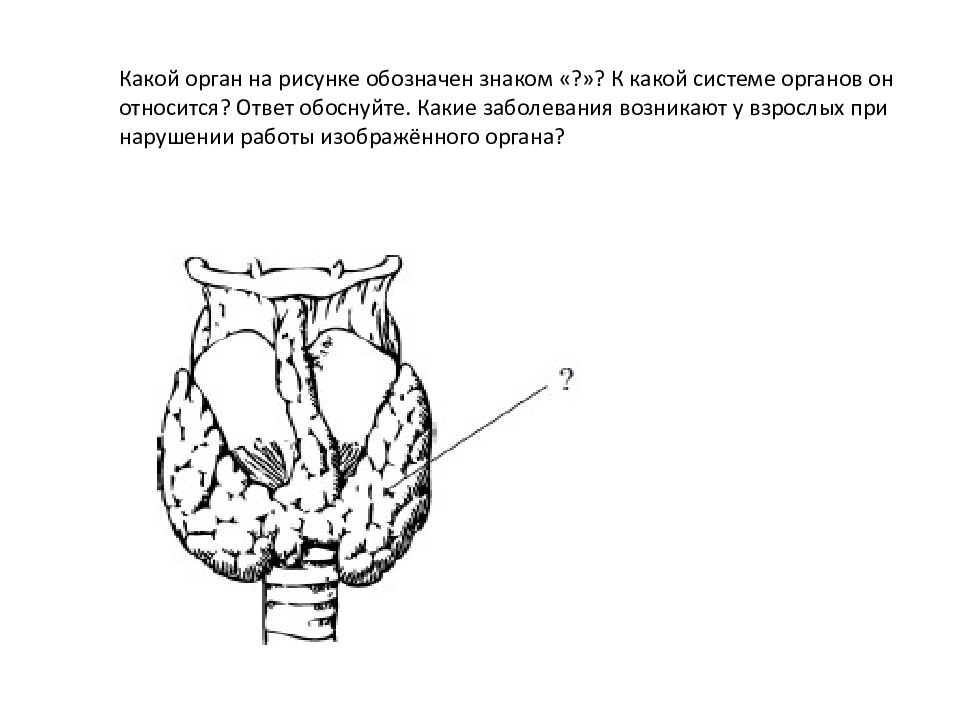 Какой буквой на рисунке обозначен орган. Обозначить органы на рисунке. Какой орган на рисунке обозначен. Какой орган на рисунке обозначен к какой системе органов он относится. Какая система органов изображена на рисунке.