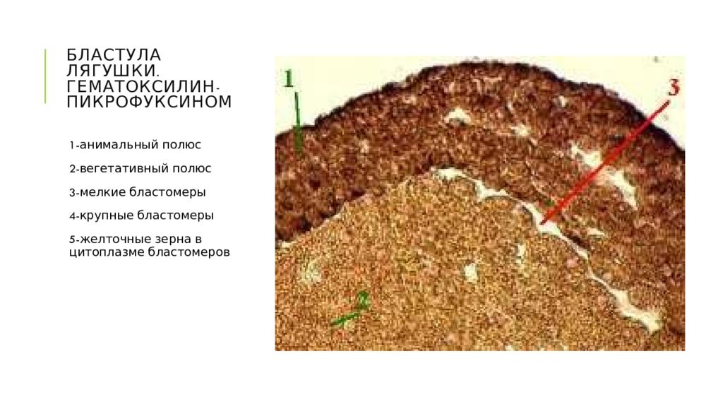 Бластула лягушки. Бластула лягушки пикрофуксин. Бластула лягушки (гематоксилин + пикрофуксин). Амфибластула лягушки препарат. Бластула лягушки препарат гистология.