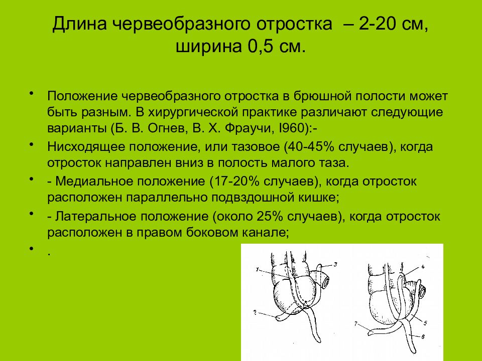 Положение см. Червеобразный отросток длина. Положения червеобразного отростка. Положение червеобразного отростка в брюшной полости. Варианты червеобразного отростка в брюшной полости.