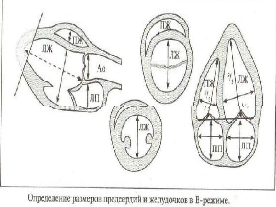 Узи сердца схема