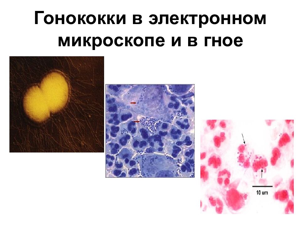 Гонококк. Гонококки микробиология морфология. Гонококки форма бактерии. Гонококк строение микробиология.