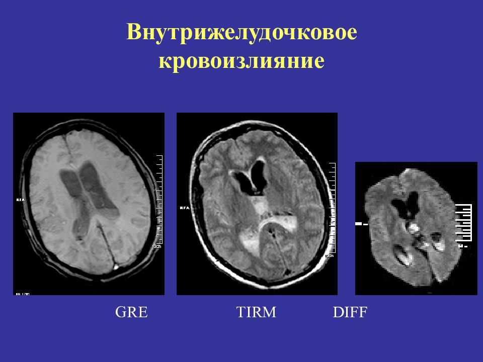 Лучевая диагностика в неврологии презентация