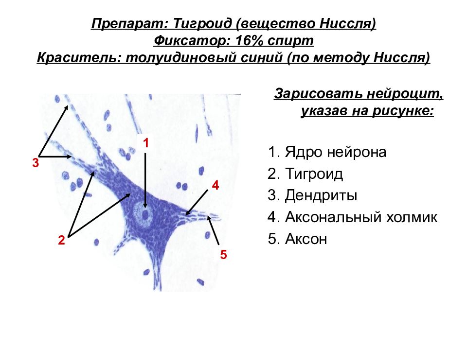 Вещество препарат. Гигроид в нервных клетках препарат гистология. Тигроид в нервных клетках спинного мозга. Глыбки Ниссля. Тигроид в нервных клетках спинного мозга препарат.