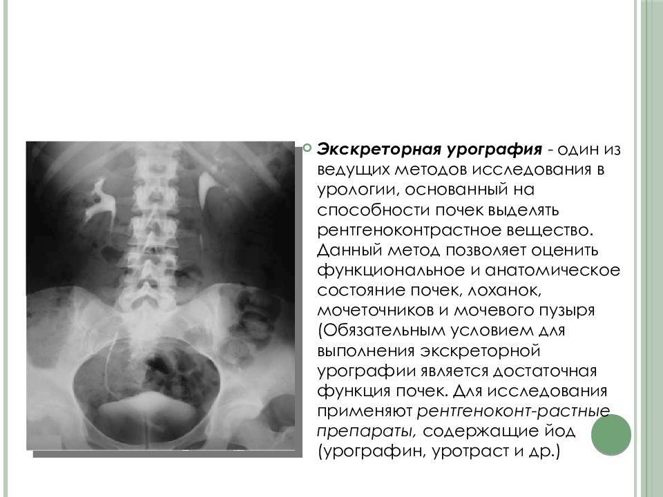 Экскреторная урография презентация