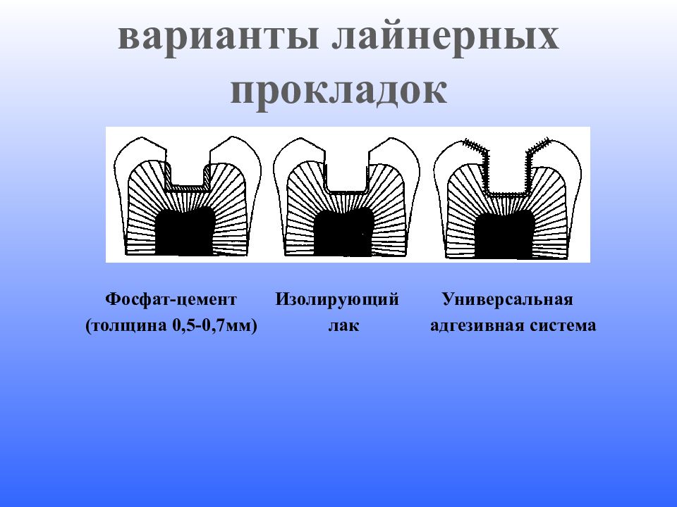 Лечебные и изолирующие прокладки презентация