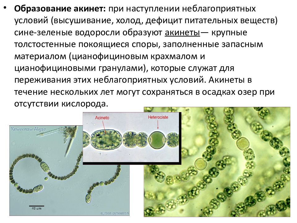 Клетки водорослей и цианобактерий. Цианобактерии акинеты. Синезелёные водоросли цианобактерии. Отдел цианобактерии сине-зеленые водоросли. Синезелёные водоросли прокариоты.