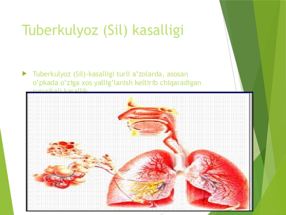 O'PKA OBSTRUKTIV YETISHMOVCHILIGI DIAGNOSTIKASI Tuberkulyoz ( Sil ) kasalligi