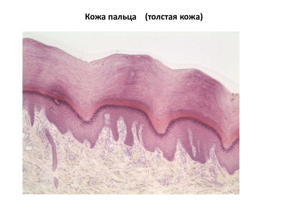 Кожа пальца (толстая кожа)