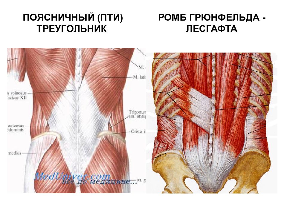 Стенки поясничного треугольника