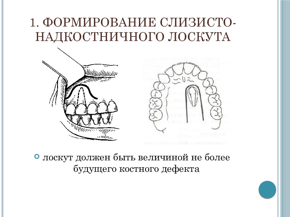 Цистотомия и цистэктомия