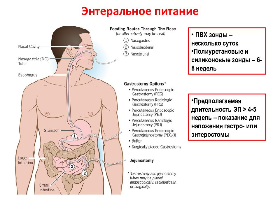 Энтеральное питание что это