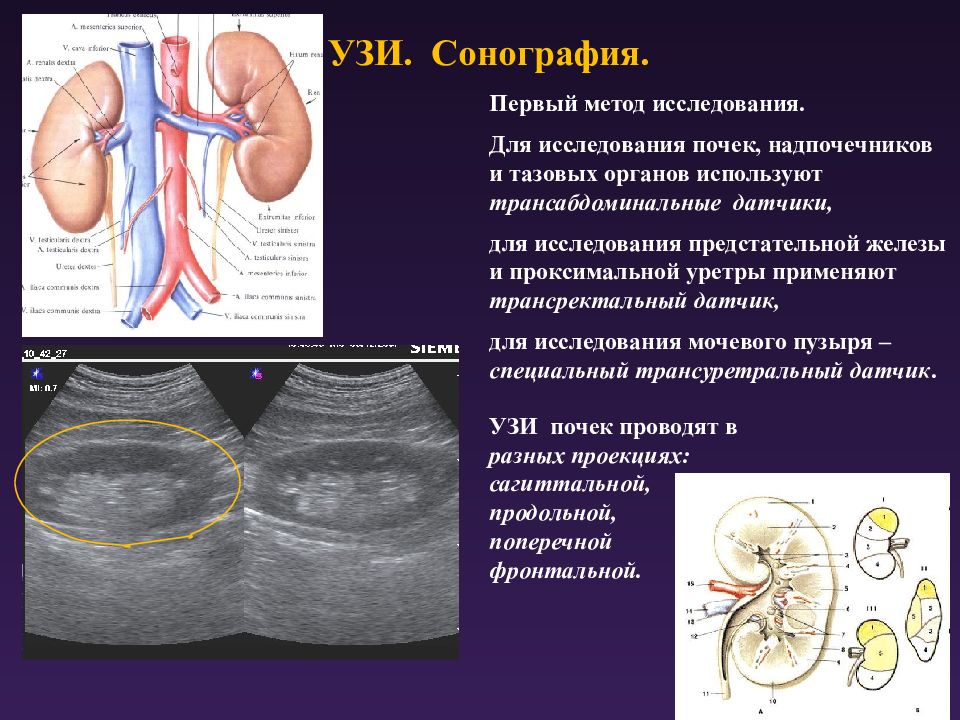 Узи мочевого пузыря подготовка к исследованию. Ультразвуковые исследования(сонография ) почек. Почки алгоритм исследования УЗИ. УЗИ почек методика исследования. УЗИ почек и мочевого пузыря презентация.