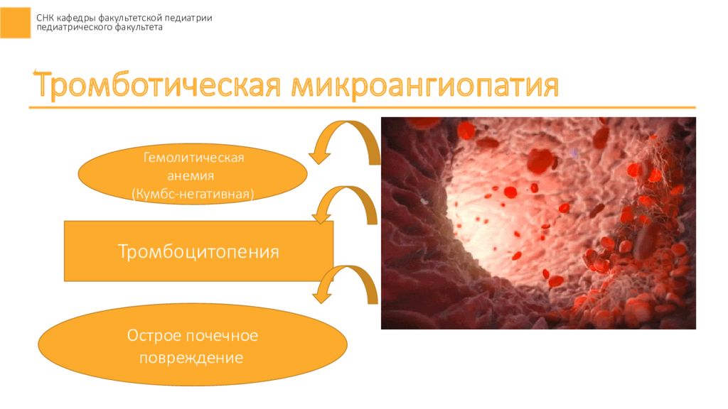 Гемолитическая кишечная. Тромбоцитарная микроангиопатия. Гемолитико-уремический синдром у детей. Негативной микроангиопатической гемолитической анемией. Микроангиопатия почек.