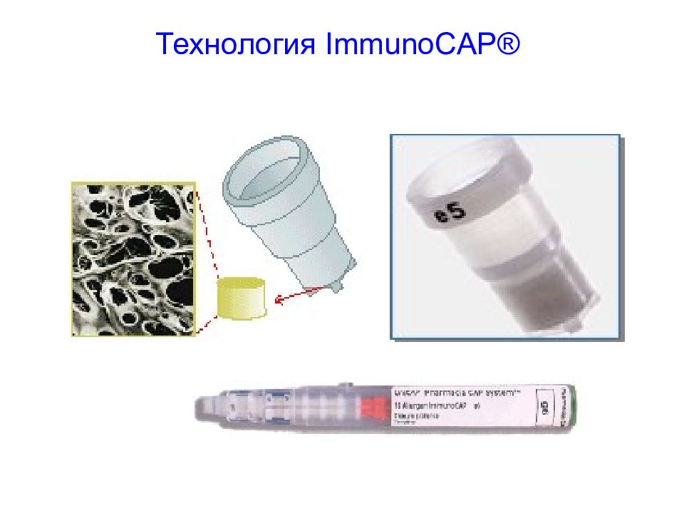 Immunocap. Аллергопробы иммунокап. Технология IMMUNOCAP. Набор для IMMUNOCAP. Метод иммунокап аллергия.