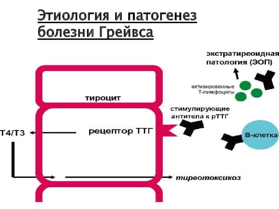 Болезнь грейвса