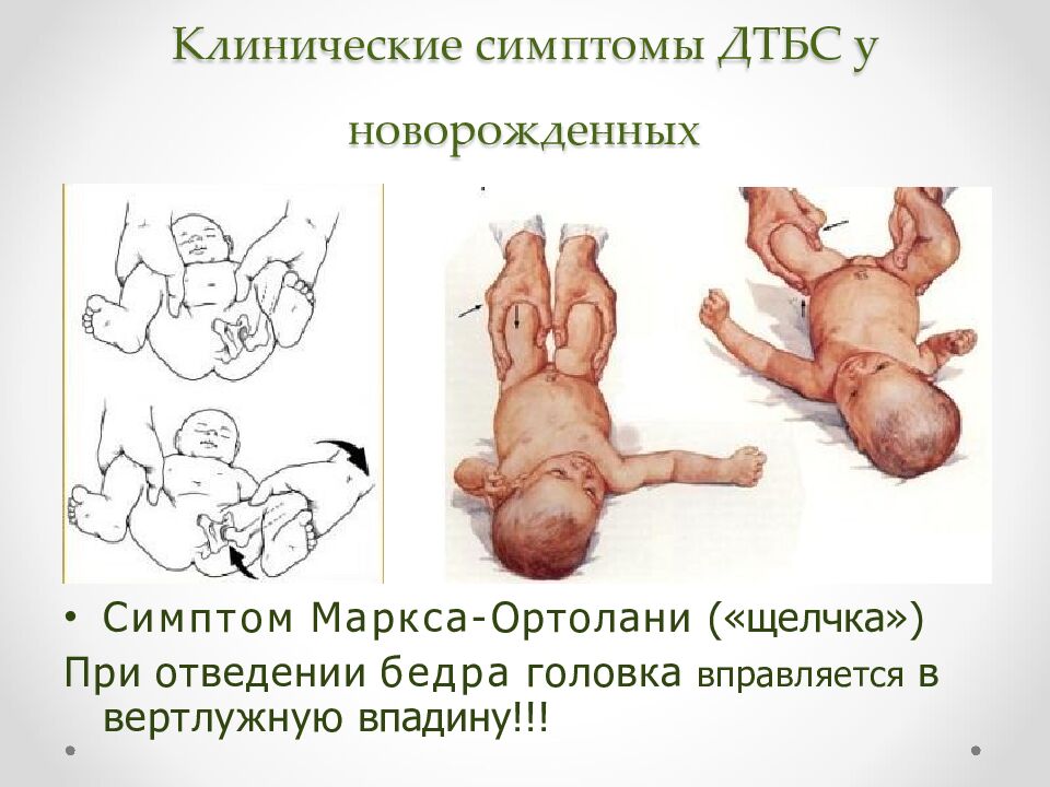 Клинические симптомы ДТБС у новорожденных