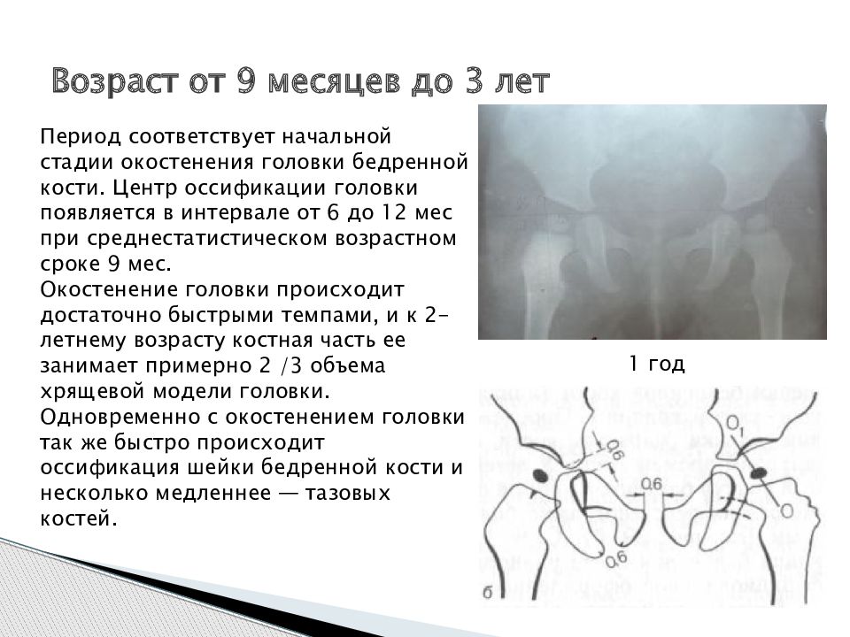 Ядро головки бедренной кости. Антеторсия тазобедренных суставов. Ядра окостенения тазобедренного сустава возрастные. Схема ТБС дисплазия. Ядра окостенения тазобедренных суставов у детей норма в 3 месяца.