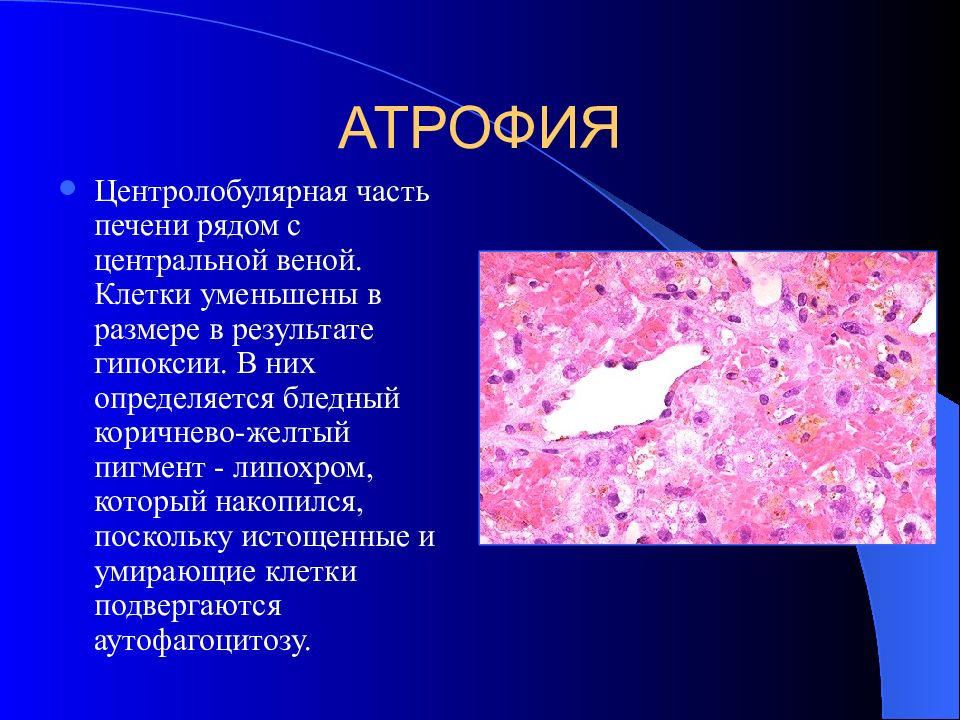 Атрофия латынь. Регенерация гипертрофия атрофия. Атрофия патологическая анатомия.