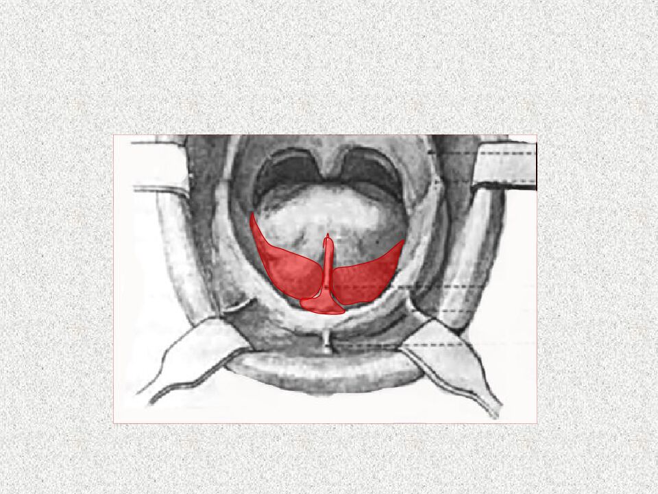 Funksional otisklar uchun individual qoshiqchalar