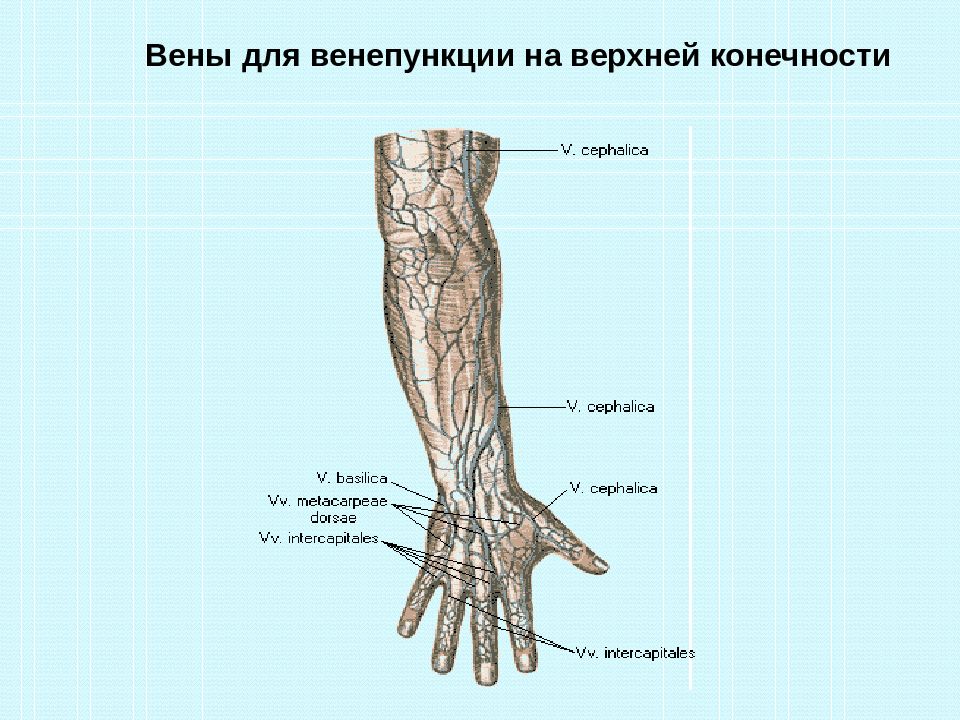 Типы вен. Вены верхней конечности венепункция. Места расположения вен для венепункции. Топография вен верхних конечностей для венепункции.