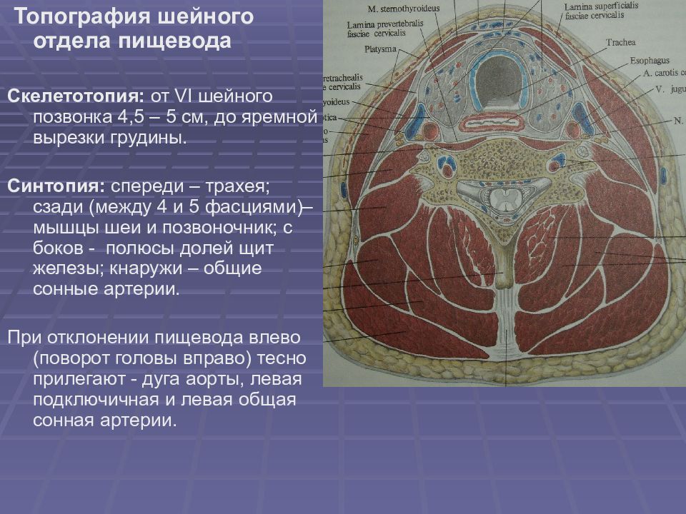 Топографическая анатомия и оперативная хирургия шеи презентация