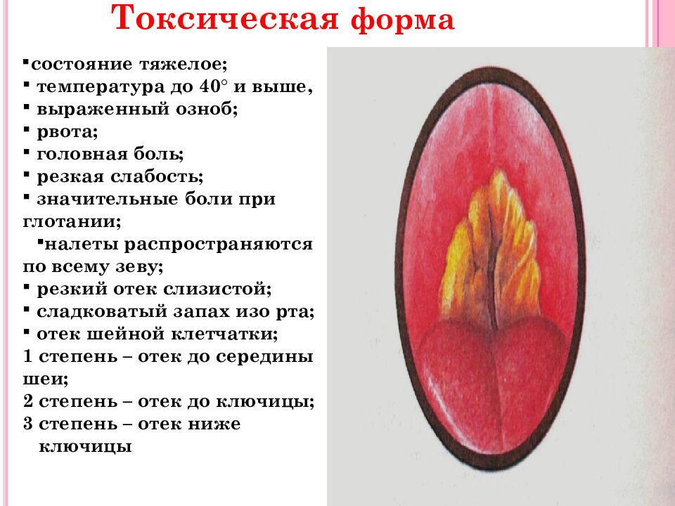 Токсическая форма