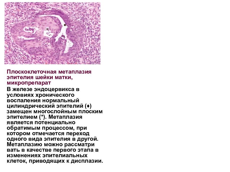 Клетки эндоцервикального эпителия. Гравидарная гиперплазия эндометрия. Эндоцервикальный эпителий. Соскоб из полости матки при беременности микропрепарат. Соскоб матки при беременности микропрепарат.