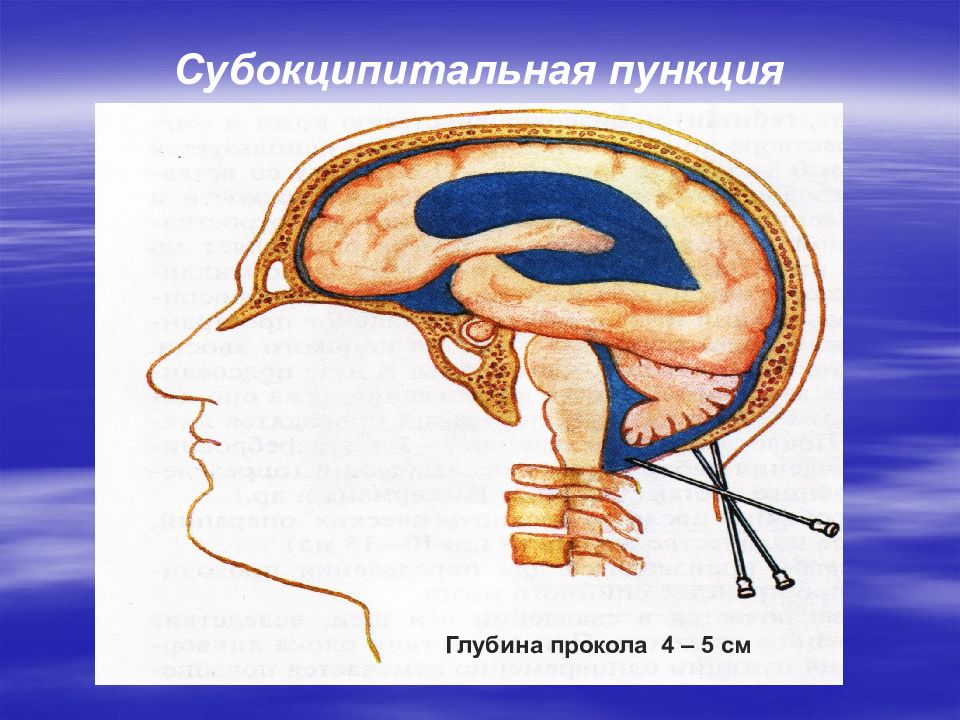 Презентация операции на голове