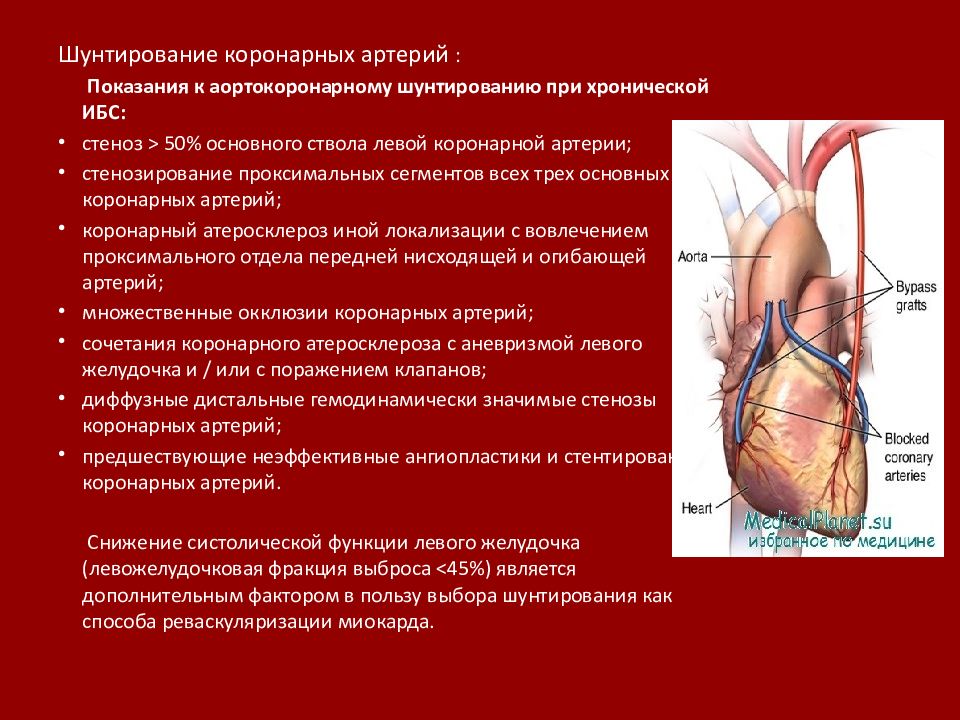 Ишемическая болезнь презентация. Поражение коронарных артерий. Шунтирование коронарных артерий. Гемодинамический значимый стеноз коронарных артерий.