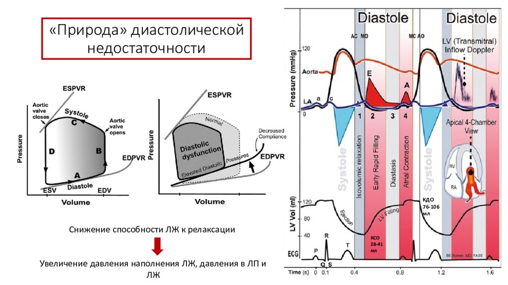 Диастолическое давление левого желудочка