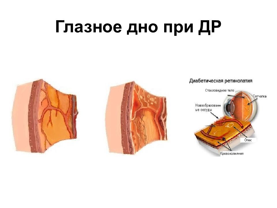 Патология 1