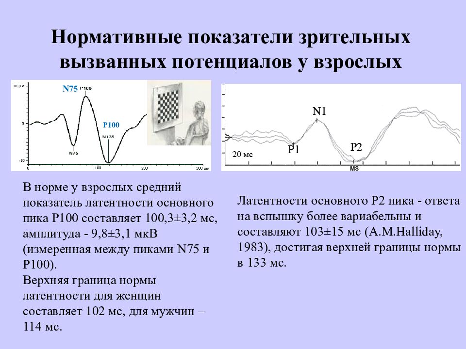 Зрительные вызванные потенциалы