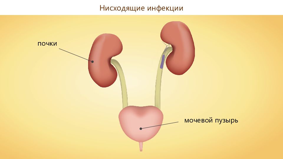 Заболевания органов мочевыделения презентация 8 класс пасечник