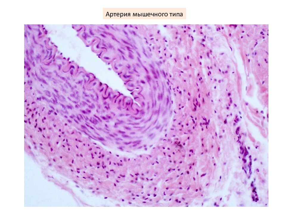 Вена препарат. Артерия мышечного типа гистология. Бедренная артерия гистология. Артерия гистология препарат. Артерии смешанного типа гистология.