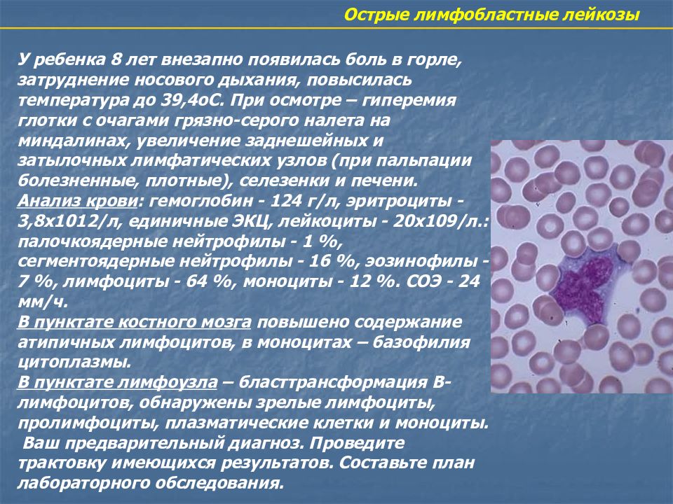 Острые лимфобластные лейкозы по утвержденным клиническим рекомендациям. Анализ крови при остром лейкозе. Анализ крови при острых лейкозах. Острый лимфолейкоз анализ. Общий анализ крови при остром лимфобластном лейкозе.