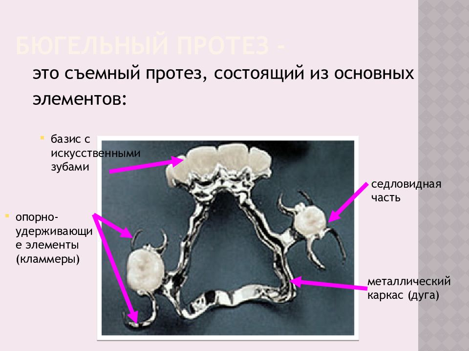 Бюгельное протезирование презентация