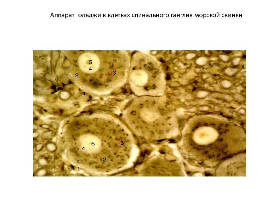 Клетка позвоночных. Комплекс Гольджи в нейронах спинального ганглия. Аппарат Гольджи в клетках спинального ганглия препарат. Пластинчатый комплекс в нервных клетках спинального ганглия. Комплекс Гольджи в клетках спинального ганглия импрегнация серебром.