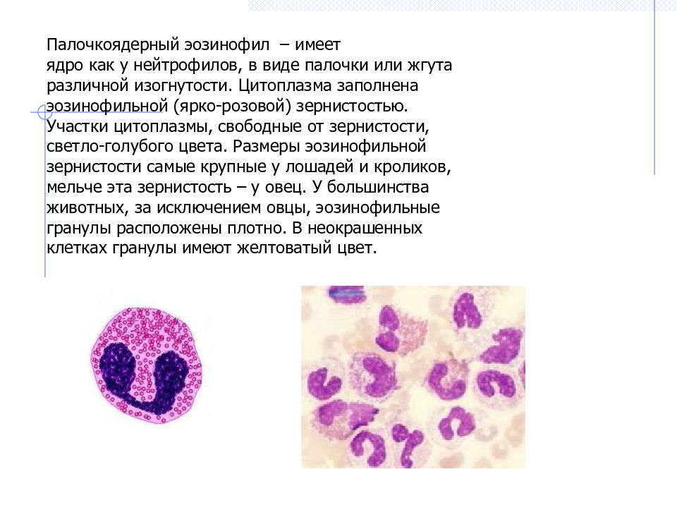 Эозинофилы цвет. Палочкоядерные и сегментоядерные лейкоциты. Нейтрофилы гистология. Палочкоядерные нейтрофилы препарат.