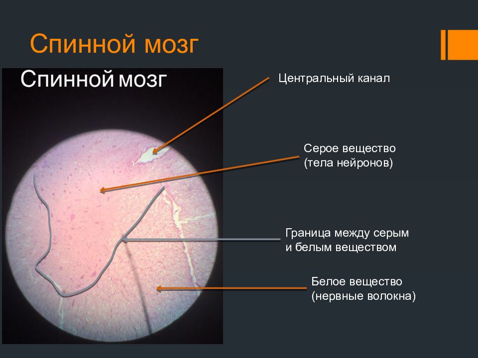 Серое вещество гистология. Серое вещество гистология. Строение спинного мозга гистология. Поперечный срез спинного мозга. Поперечный срез спинного мозга гистология препарат.