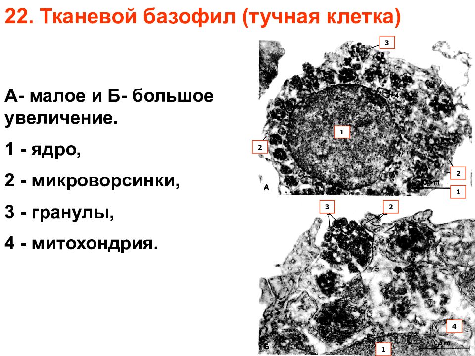 Базофил электронограмма. Электронограмма ядрышка клетки. Электронограммы гистология. Электронограммы гистология. Электронограммы гистология.
