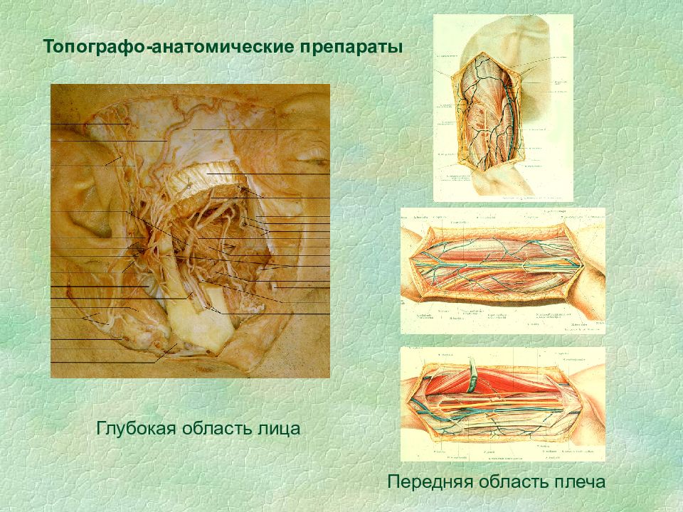 Топографическая хирургия. Препараты по топографической анатомии. Швы топографическая анатомия.